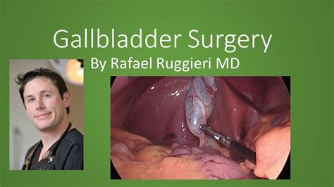 Unforeseen Challenges of Living Without a Gallbladder: A Guide to Coping